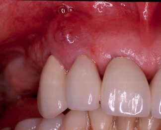 Davis8304A.jpg