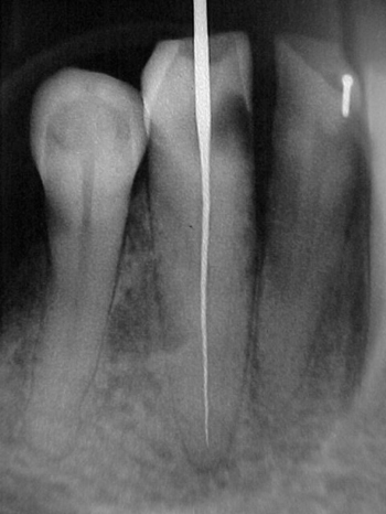 bobxray1.jpg