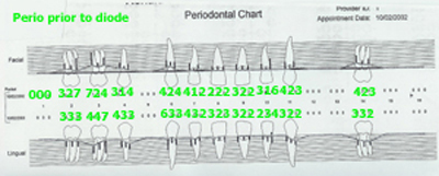 prediode1.jpg